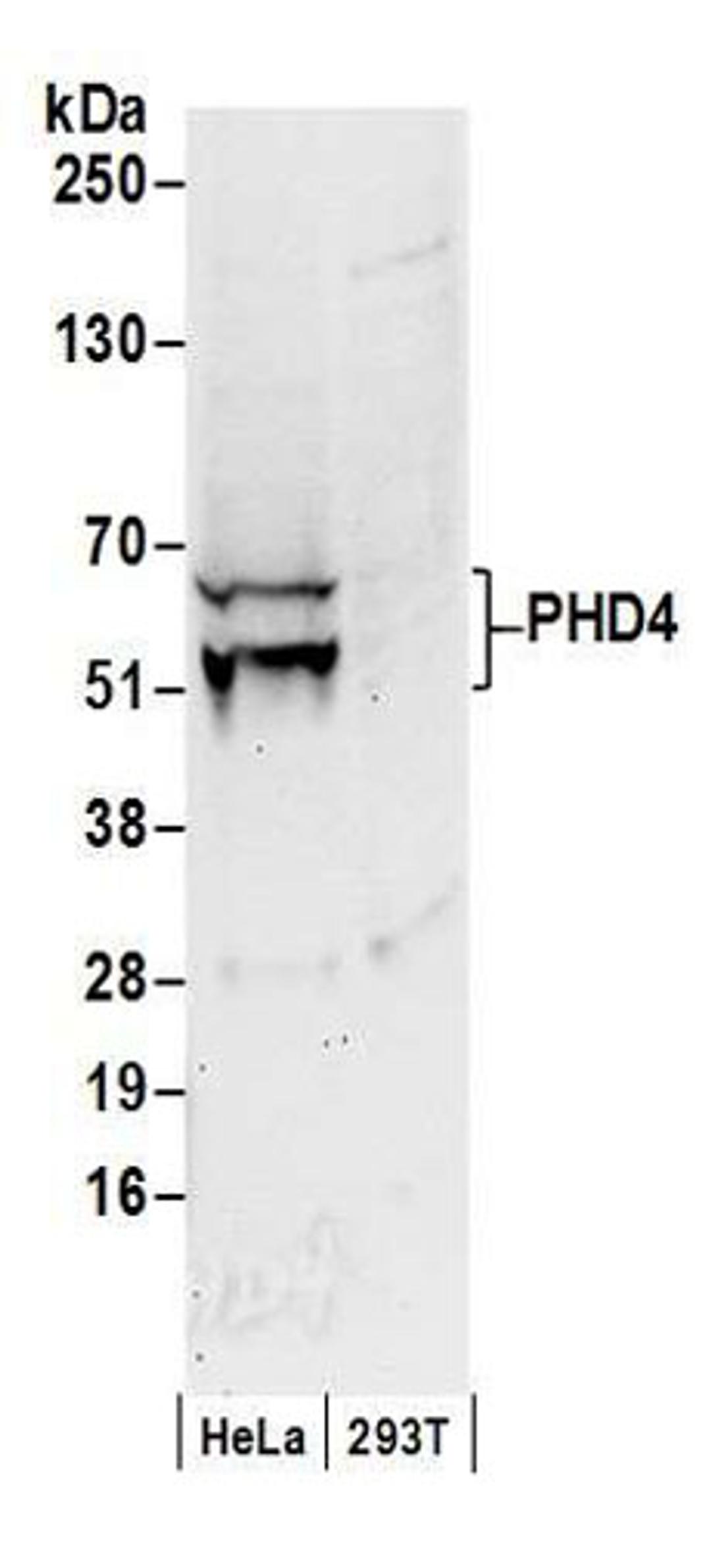 Detection of human PHD4 by western blot.