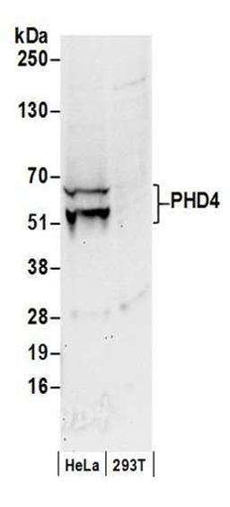 Detection of human PHD4 by western blot.