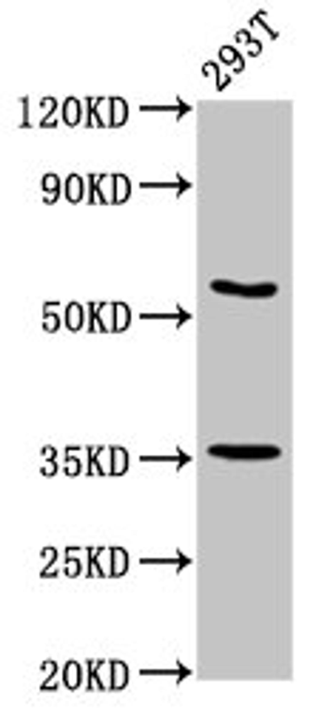 Western Blot. Positive WB detected in: 293T whole cell lysate. All lanes: LPP antibody at 7.5ug/ml. Secondary. Goat polyclonal to rabbit IgG at 1/50000 dilution. Predicted band size: 66 kDa. Observed band size: 66 kDa.