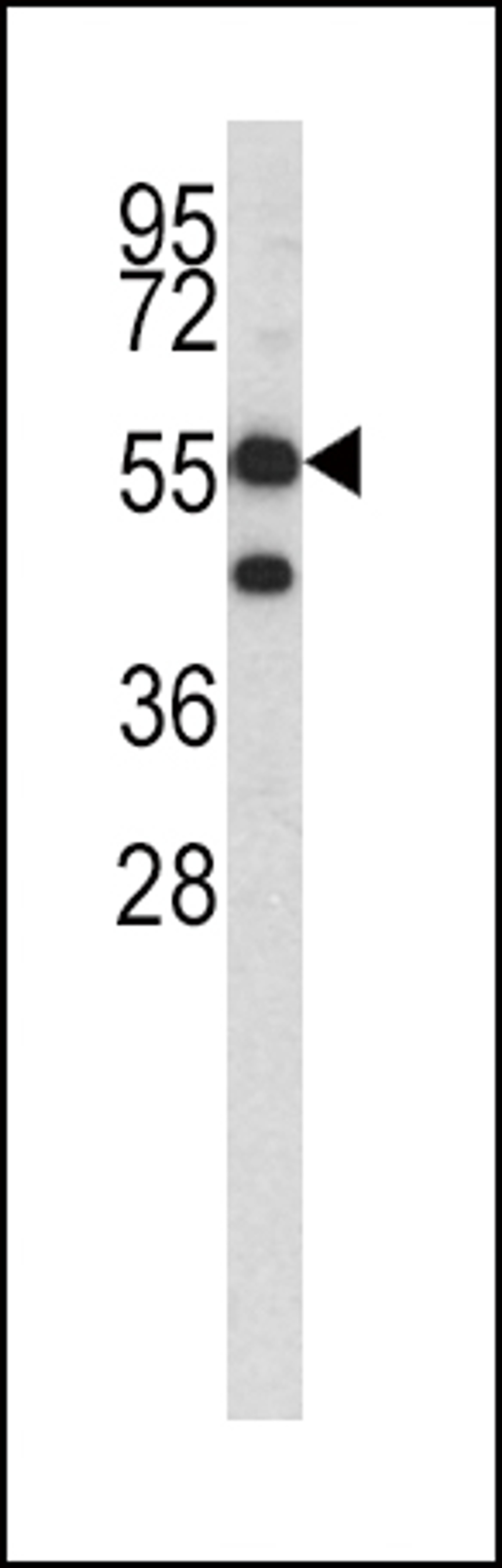 Western blot analysis of HMGCS1 antibody in K562 cell line lysates (35ug/lane)