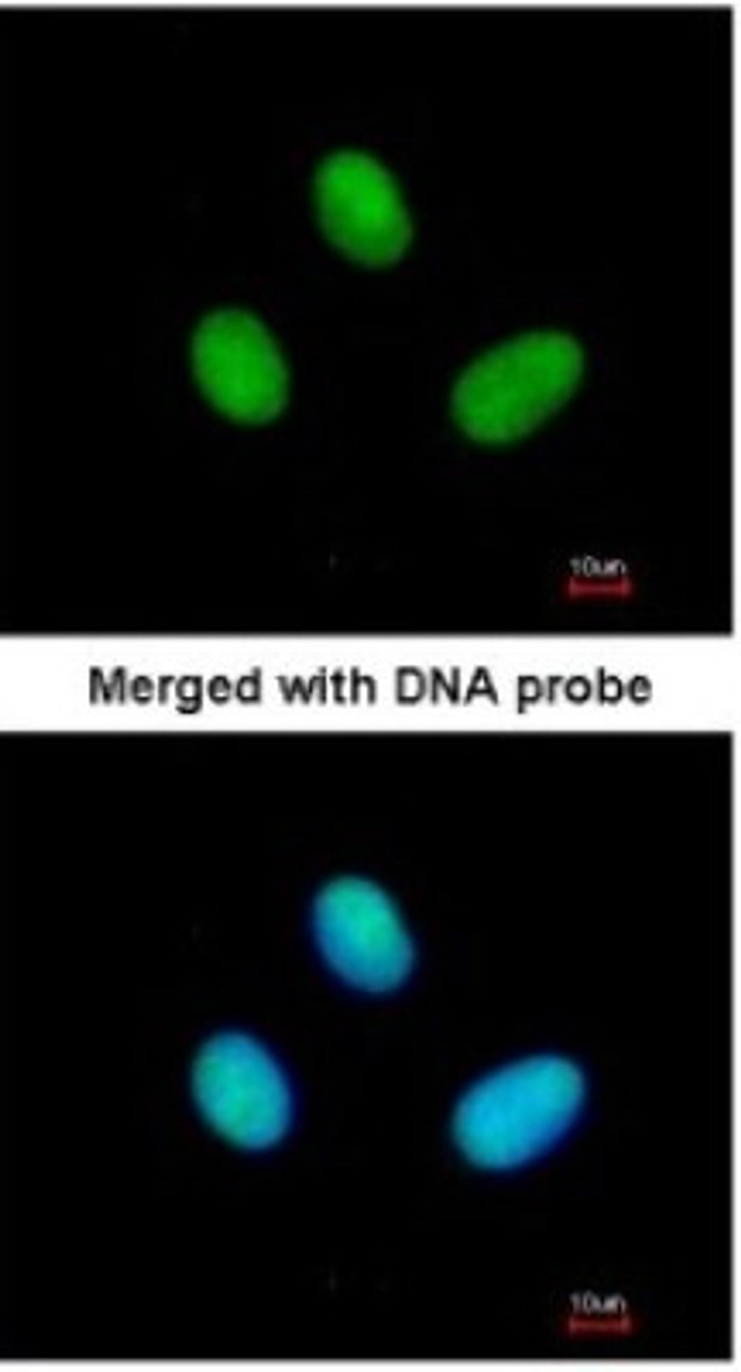 Immunocytochemistry/Immunofluorescence: RBP2 Antibody [NBP1-32370] - Paraformaldehyde-fixed HeLa, using antibody at 1:200 dilution.