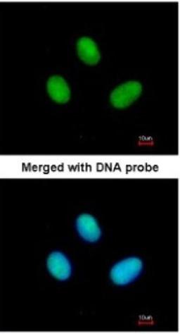 Immunocytochemistry/Immunofluorescence: RBP2 Antibody [NBP1-32370] - Paraformaldehyde-fixed HeLa, using antibody at 1:200 dilution.