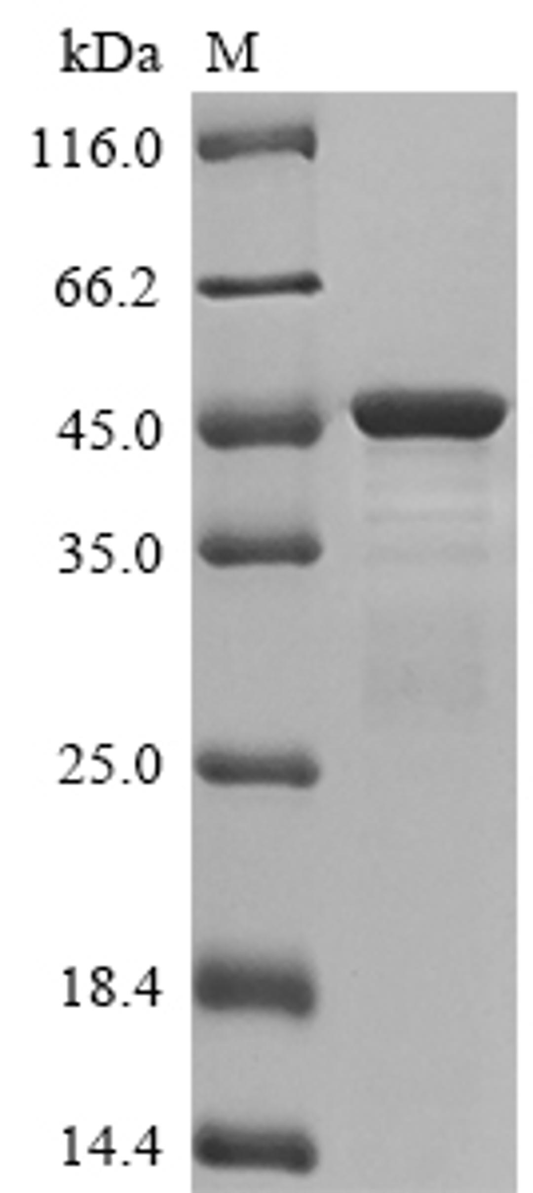 (Tris-Glycine gel) Discontinuous SDS-PAGE (reduced) with 5% enrichment gel and 15% separation gel.
