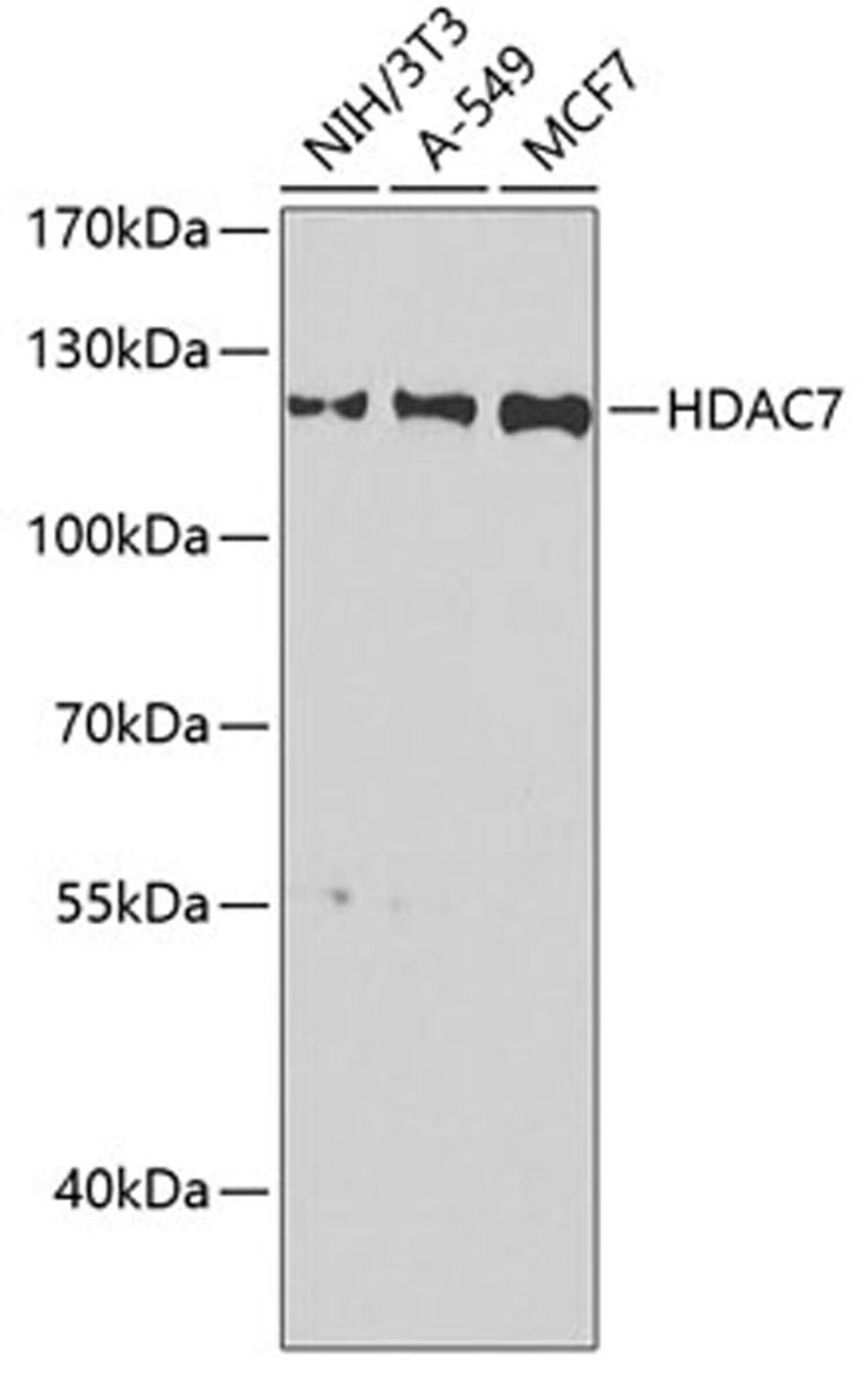 Western blot - HDAC7 antibody (A7285)