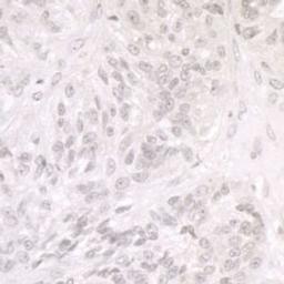 Detection of human SMARCA1/SNF2L by immunohistochemistry.