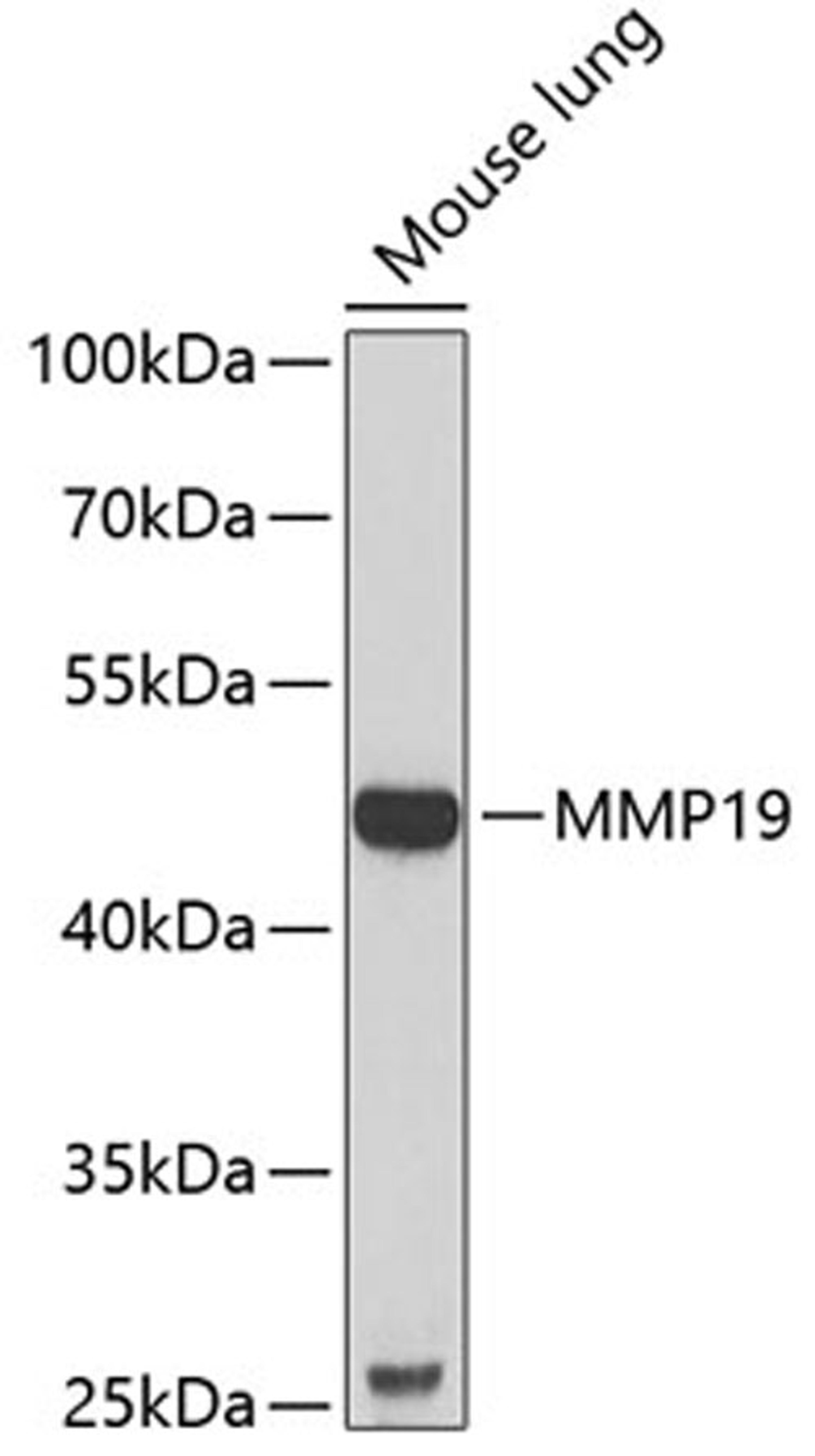 Western blot - MMP19 antibody (A6657)