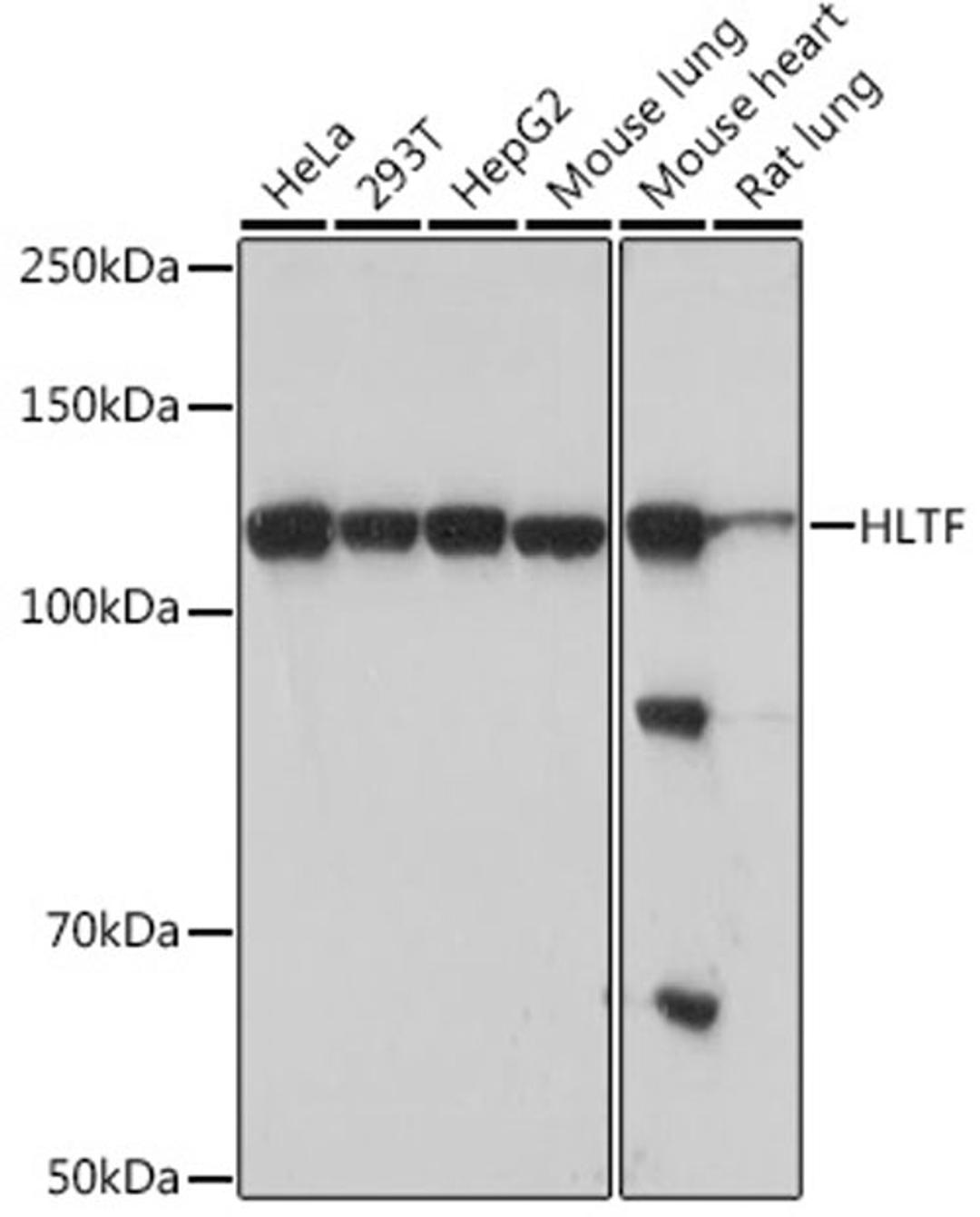 Western blot - HLTF Rabbit mAb (A5068)