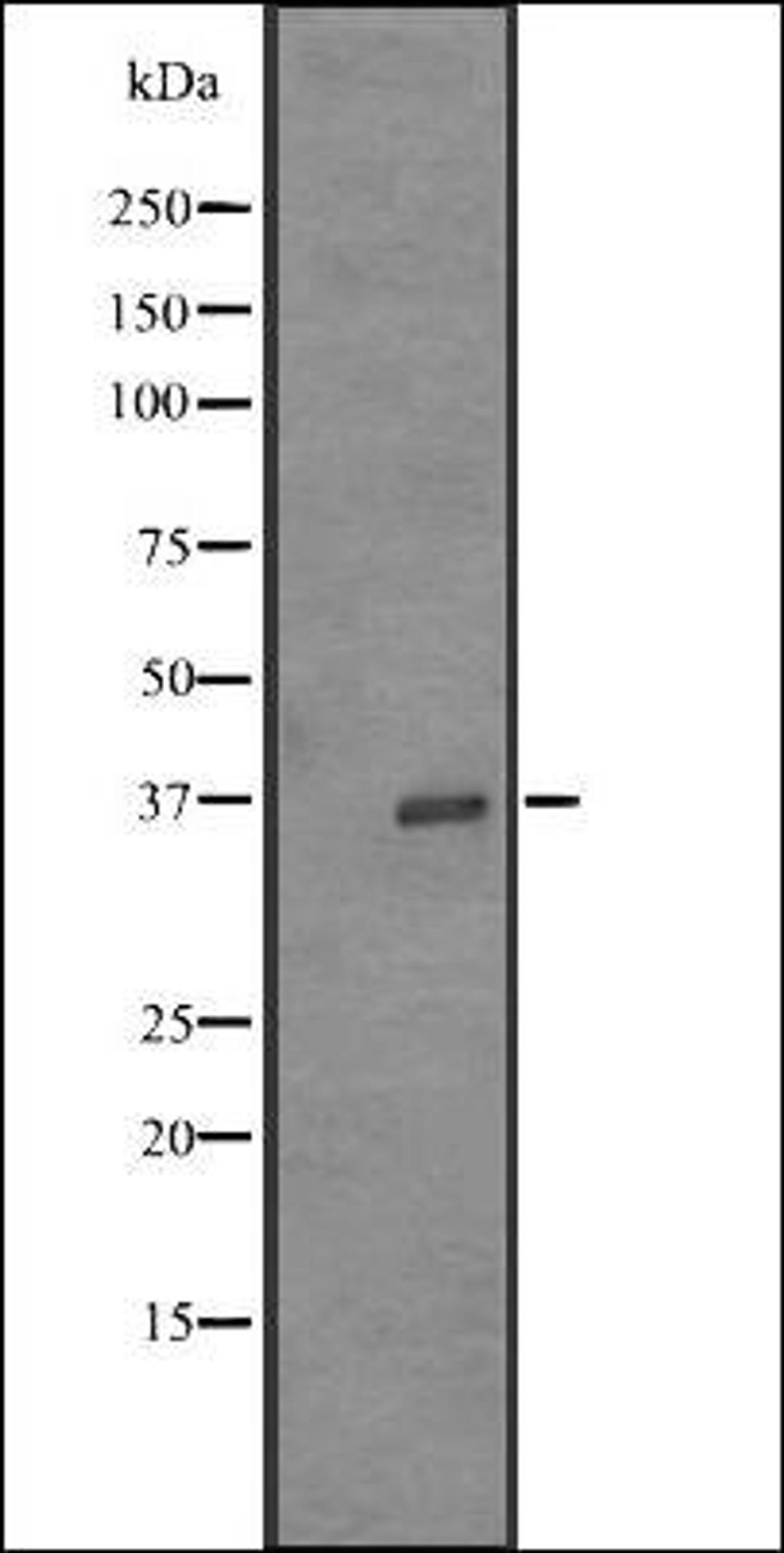 Western blot analysis of K562 cell line lysates using OR52Z1P antibody