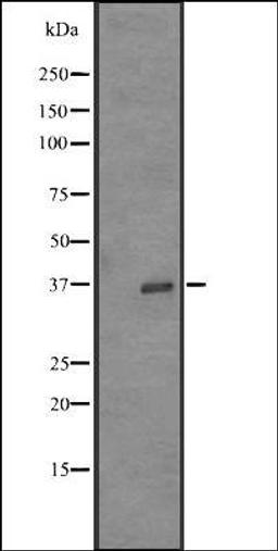 Western blot analysis of K562 cell line lysates using OR52Z1P antibody