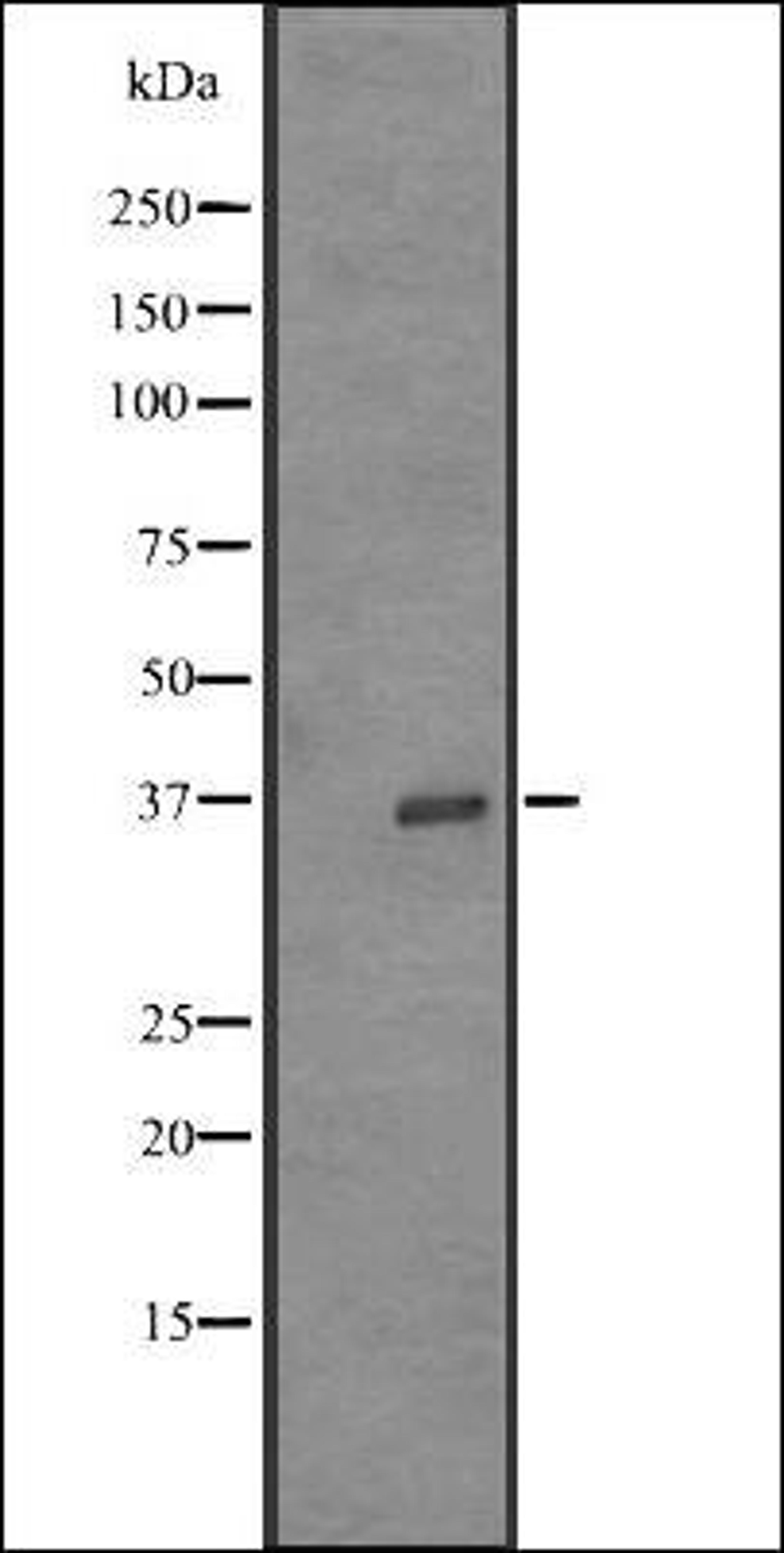 Western blot analysis of K562 cell line lysates using OR52Z1P antibody