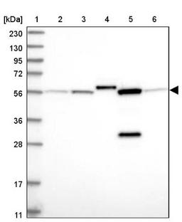 Western Blot: ALDH6A1 Antibody [NBP1-82634] - Lane 1: Marker [kDa] 230, 130, 95, 72, 56, 36, 28, 17, 11<br/>Lane 2: Human cell line RT-4<br/>Lane 3: Human cell line U-251MG sp<br/>Lane 4: Human plasma (IgG/HSA depleted)<br/>Lane 5: Human liver tissue<br/>Lane 6: Human tonsil tissue