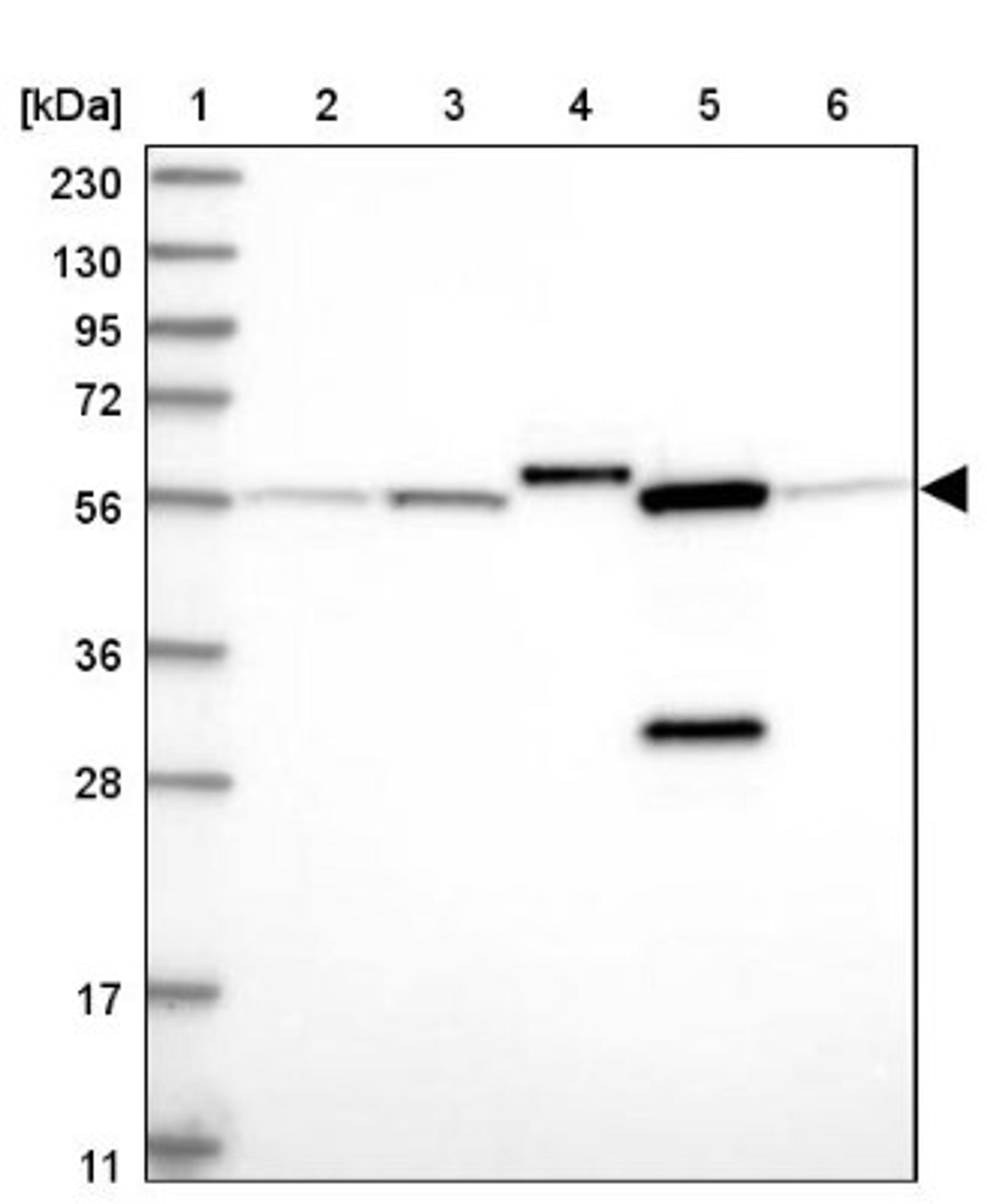 Western Blot: ALDH6A1 Antibody [NBP1-82634] - Lane 1: Marker [kDa] 230, 130, 95, 72, 56, 36, 28, 17, 11<br/>Lane 2: Human cell line RT-4<br/>Lane 3: Human cell line U-251MG sp<br/>Lane 4: Human plasma (IgG/HSA depleted)<br/>Lane 5: Human liver tissue<br/>Lane 6: Human tonsil tissue