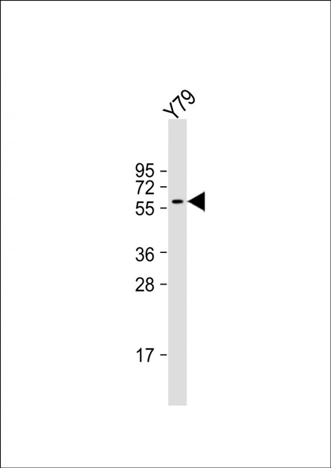 Western Blot at 1:2000 dilution + Y79 whole cell lysate Lysates/proteins at 20 ug per lane.