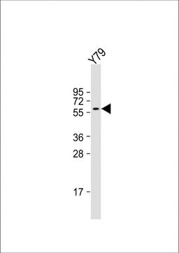 Western Blot at 1:2000 dilution + Y79 whole cell lysate Lysates/proteins at 20 ug per lane.