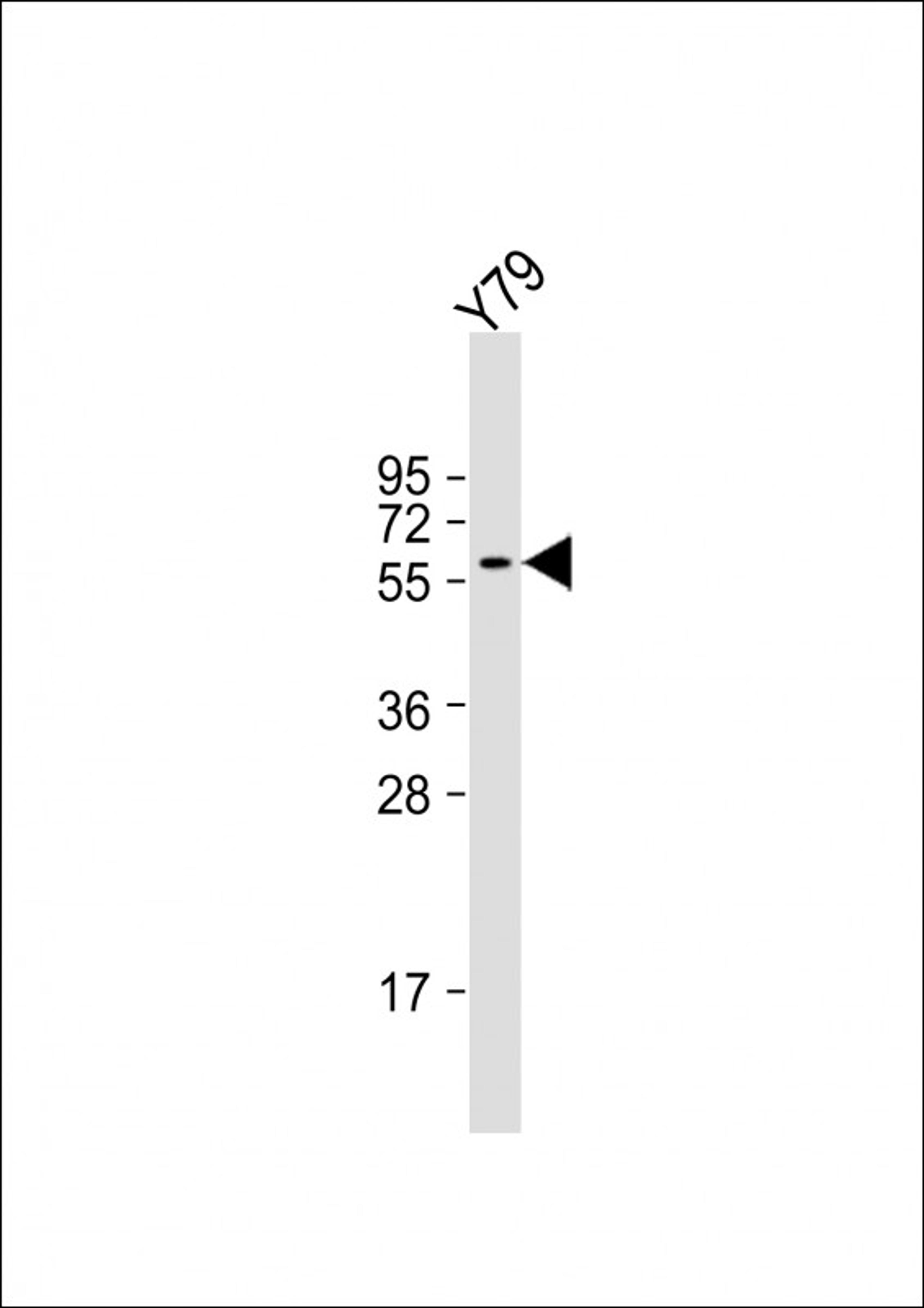 Western Blot at 1:2000 dilution + Y79 whole cell lysate Lysates/proteins at 20 ug per lane.