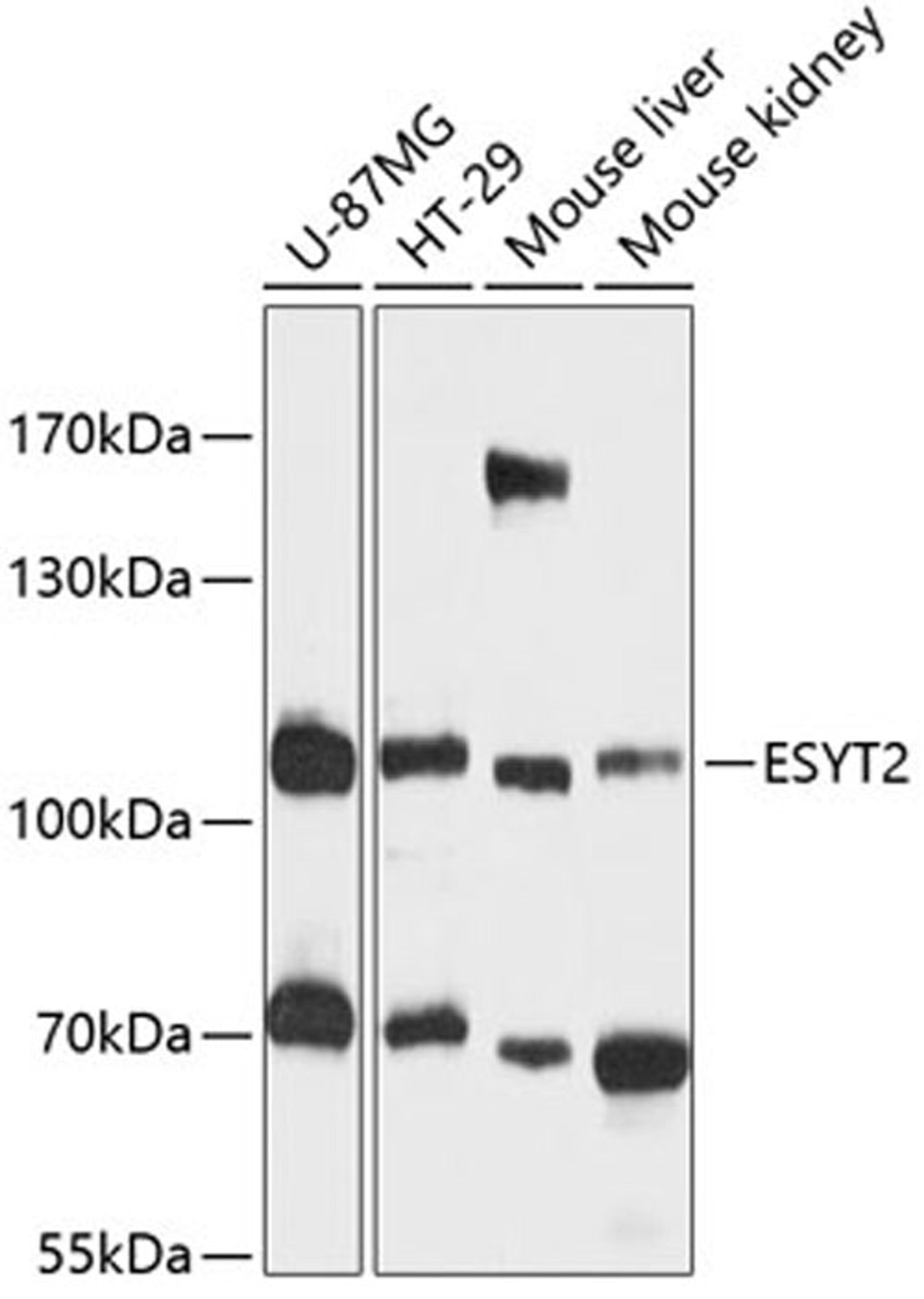 Western blot - ESYT2 antibody (A12833)