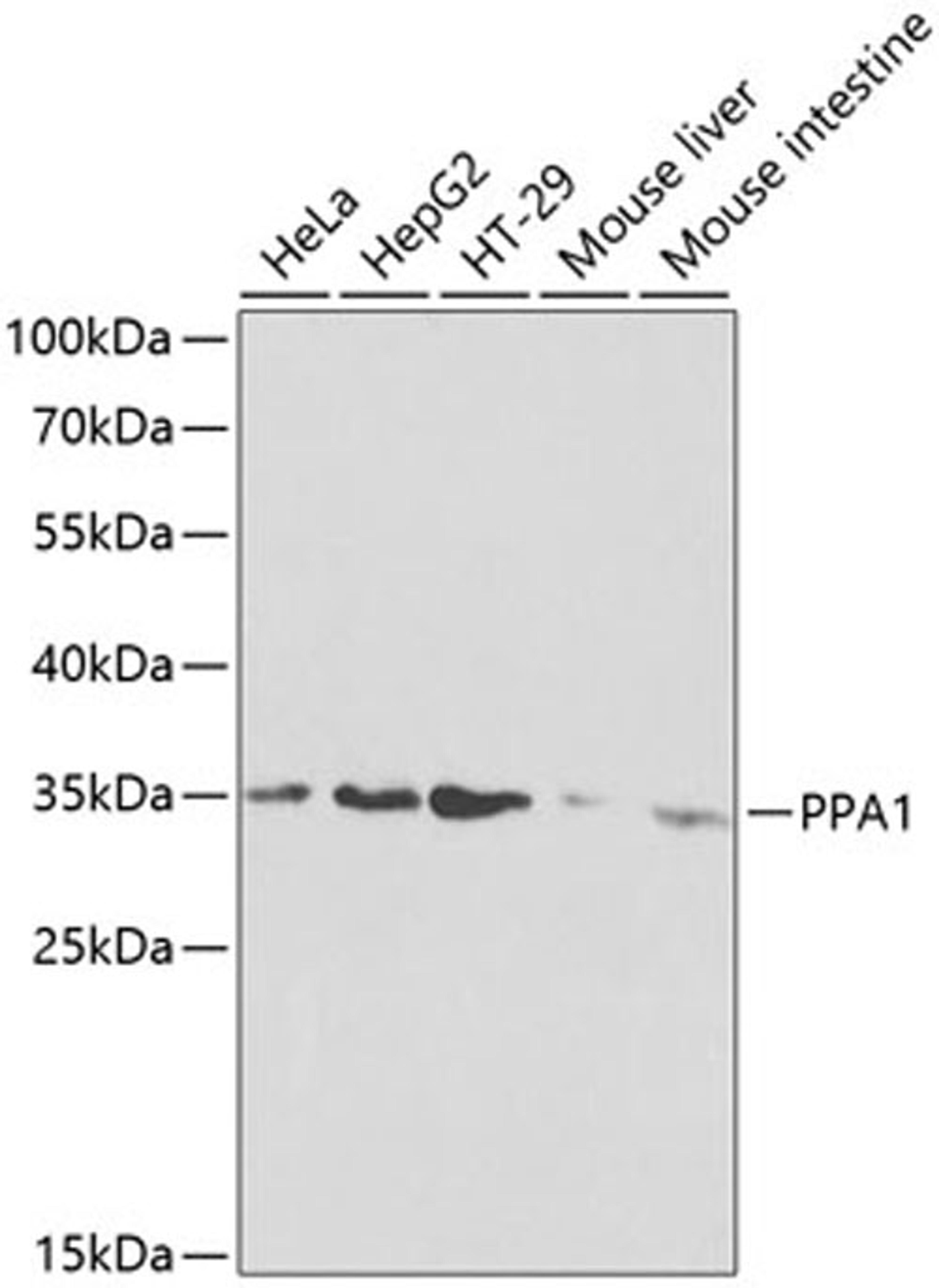 Western blot - PPA1 antibody (A2108)