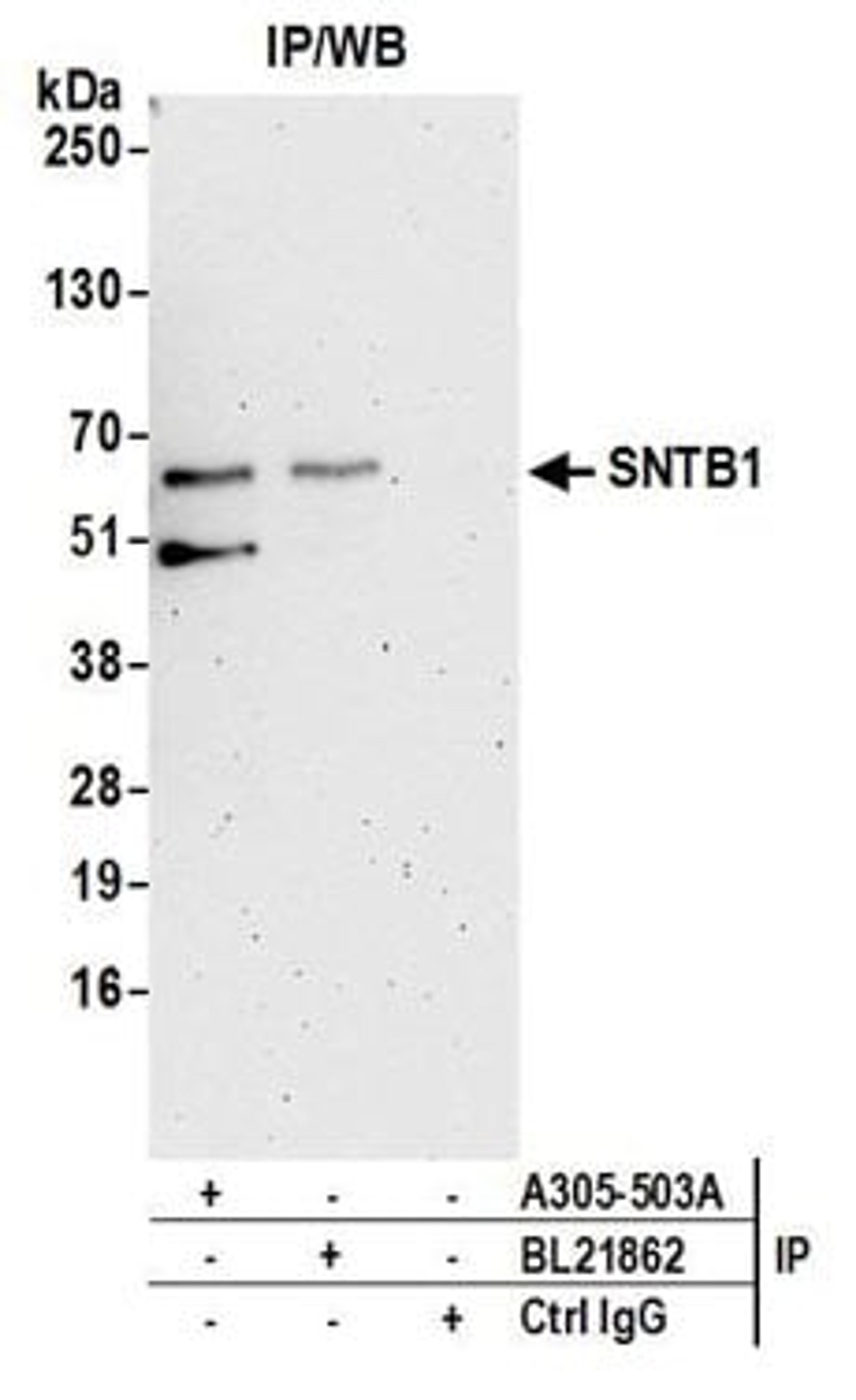 Detection of human SNTB1 by western blot of immunoprecipitates.