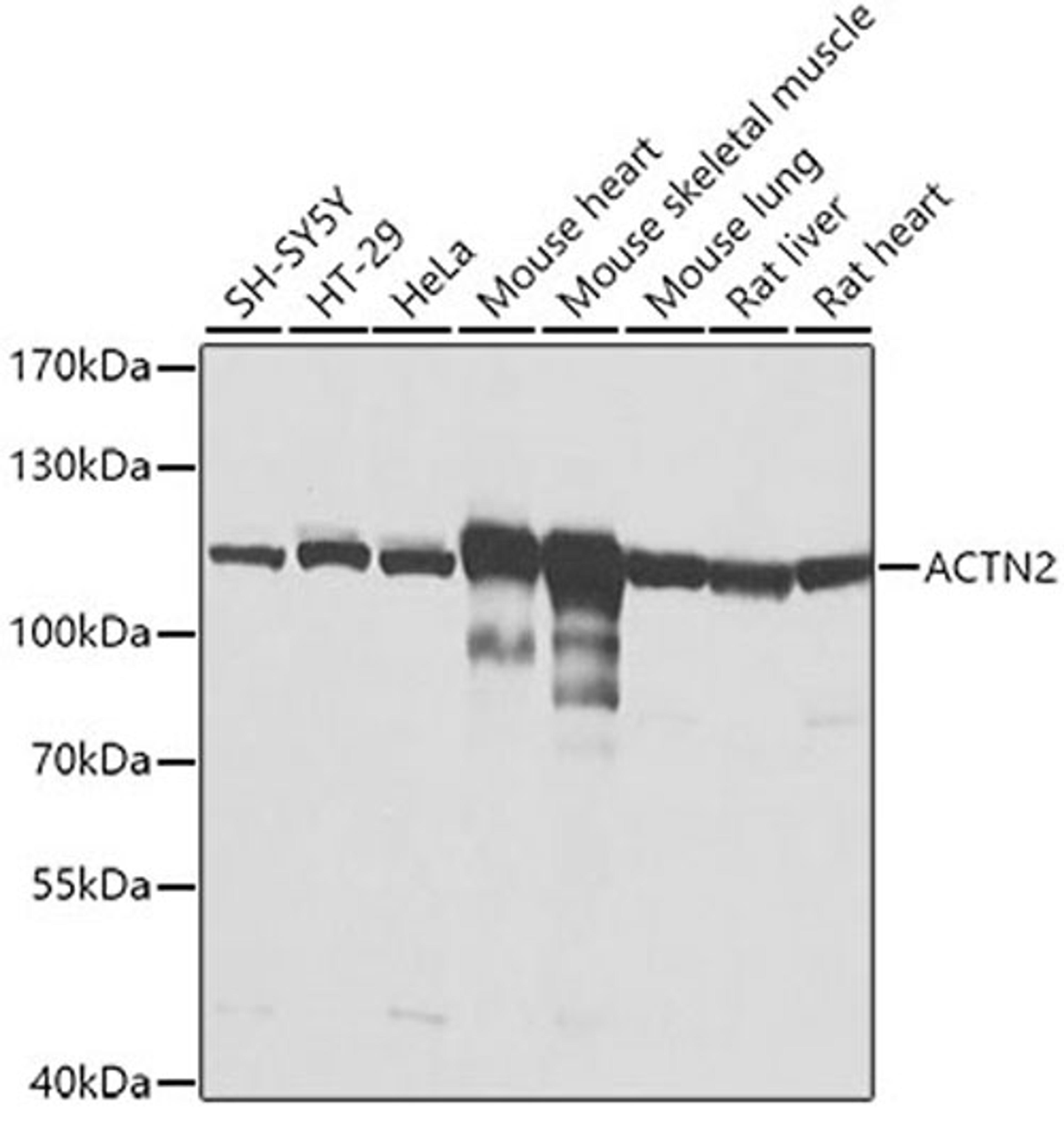Western blot - ACTN2 antibody (A3718)