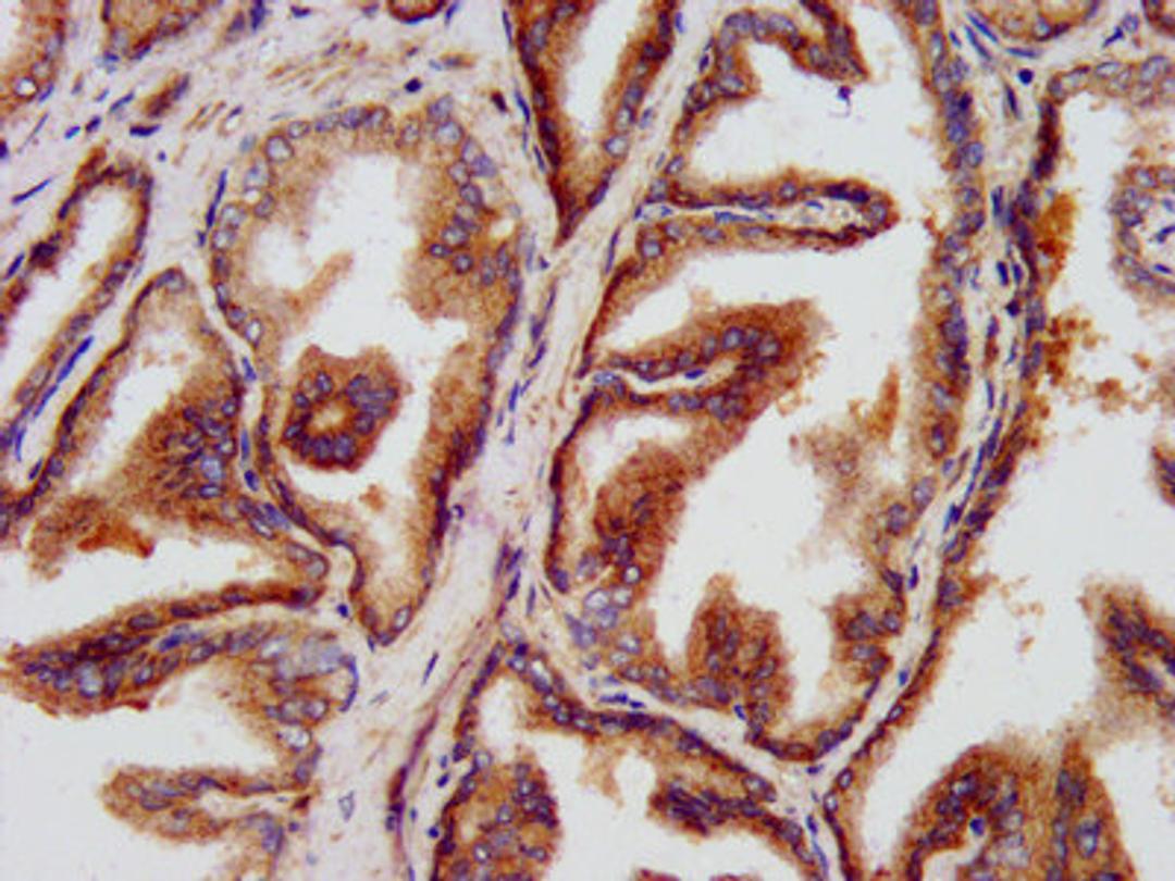 IHC image of CSB-PA22699A0Rb diluted at 1:500 and staining in paraffin-embedded human prostate tissue performed on a Leica BondTM system. After dewaxing and hydration, antigen retrieval was mediated by high pressure in a citrate buffer (pH 6.0). Section was blocked with 10% normal goat serum 30min at RT. Then primary antibody (1% BSA) was incubated at 4&deg;C overnight. The primary is detected by a biotinylated secondary antibody and visualized using an HRP conjugated SP system.