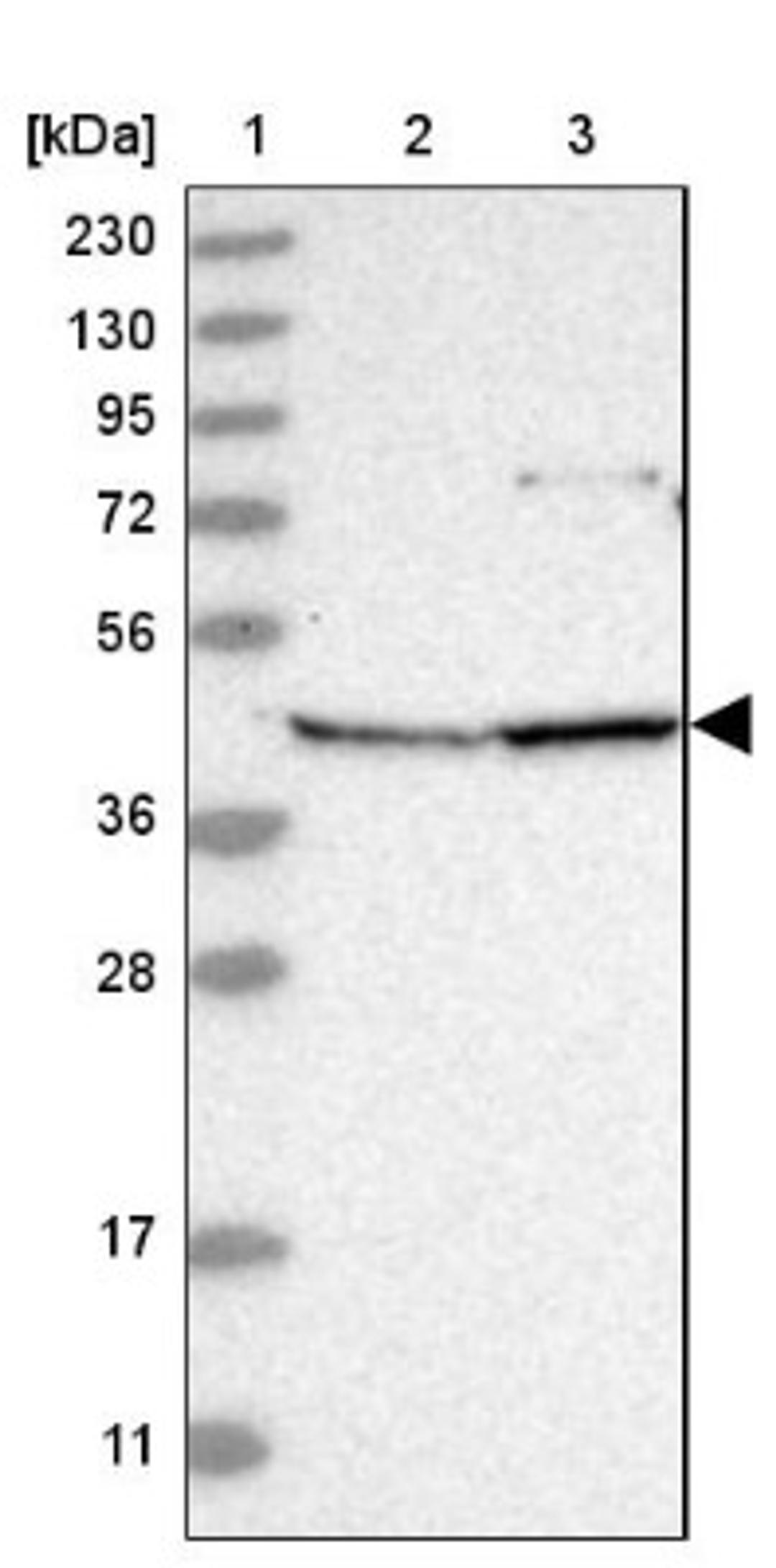 Western Blot: ANKRD34A Antibody [NBP1-90855] - Lane 1: Marker [kDa] 230, 130, 95, 72, 56, 36, 28, 17, 11<br/>Lane 2: Human cell line RT-4<br/>Lane 3: Human cell line U-251MG sp