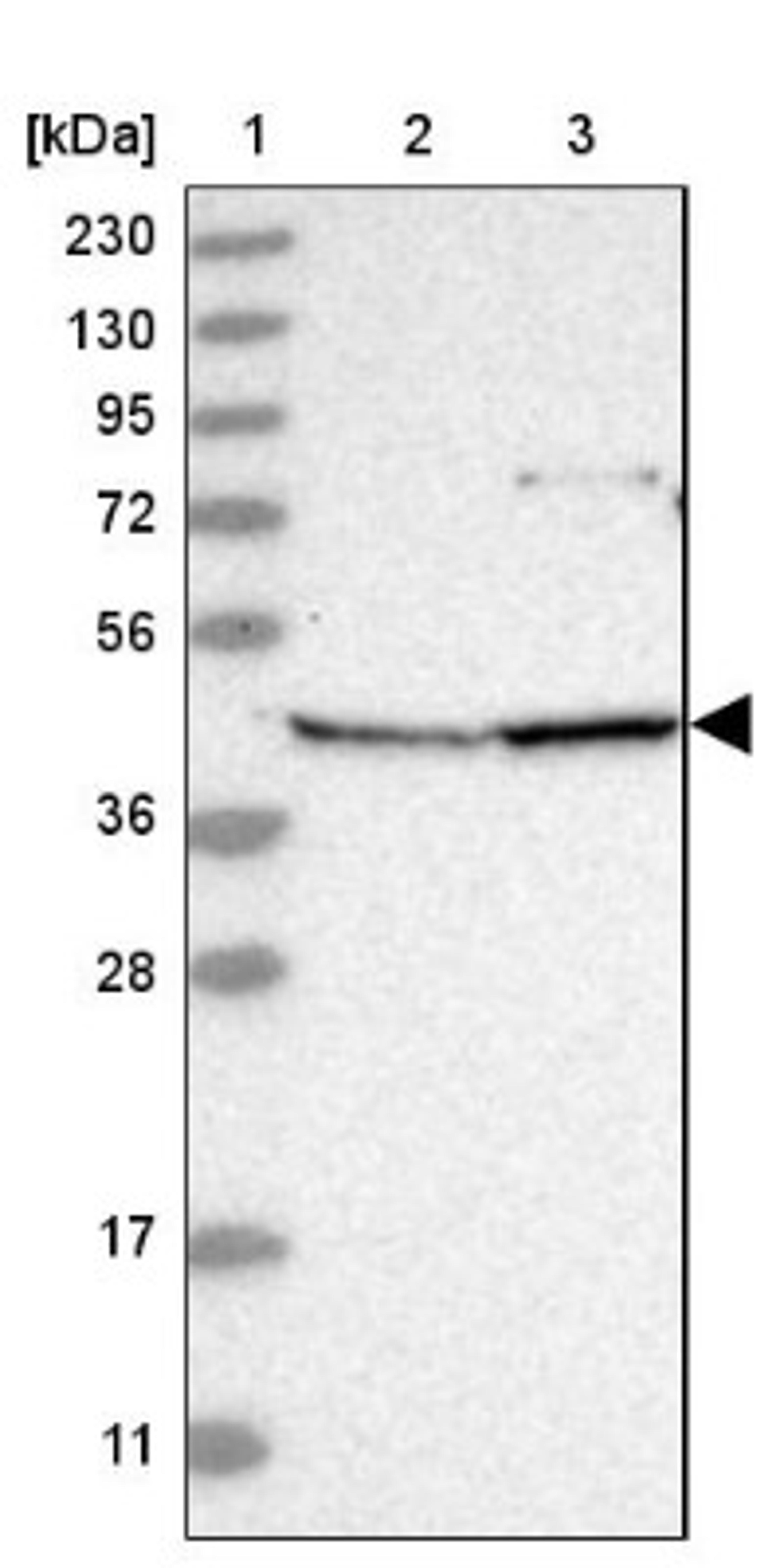 Western Blot: ANKRD34A Antibody [NBP1-90855] - Lane 1: Marker [kDa] 230, 130, 95, 72, 56, 36, 28, 17, 11<br/>Lane 2: Human cell line RT-4<br/>Lane 3: Human cell line U-251MG sp