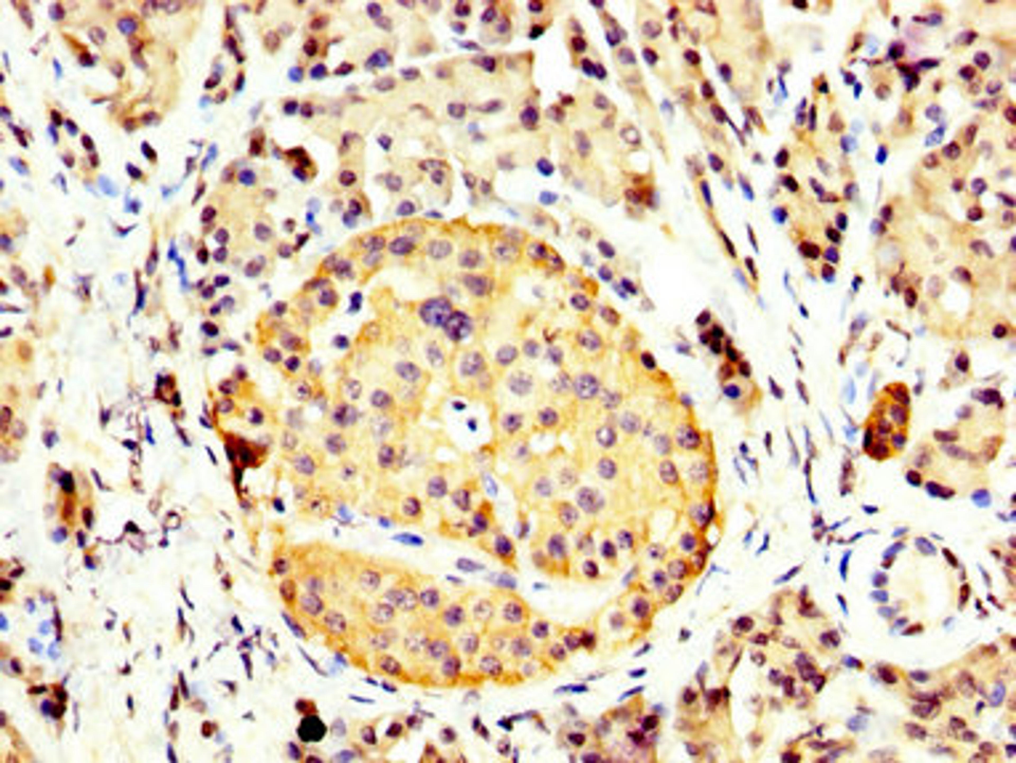 IHC image of CSB-PA12619A0Rb diluted at 1:400 and staining in paraffin-embedded human pancreatic tissue performed on a Leica BondTM system. After dewaxing and hydration, antigen retrieval was mediated by high pressure in a citrate buffer (pH 6.0). Section was blocked with 10% normal goat serum 30min at RT. Then primary antibody (1% BSA) was incubated at 4&deg;C overnight. The primary is detected by a biotinylated secondary antibody and visualized using an HRP conjugated SP system.