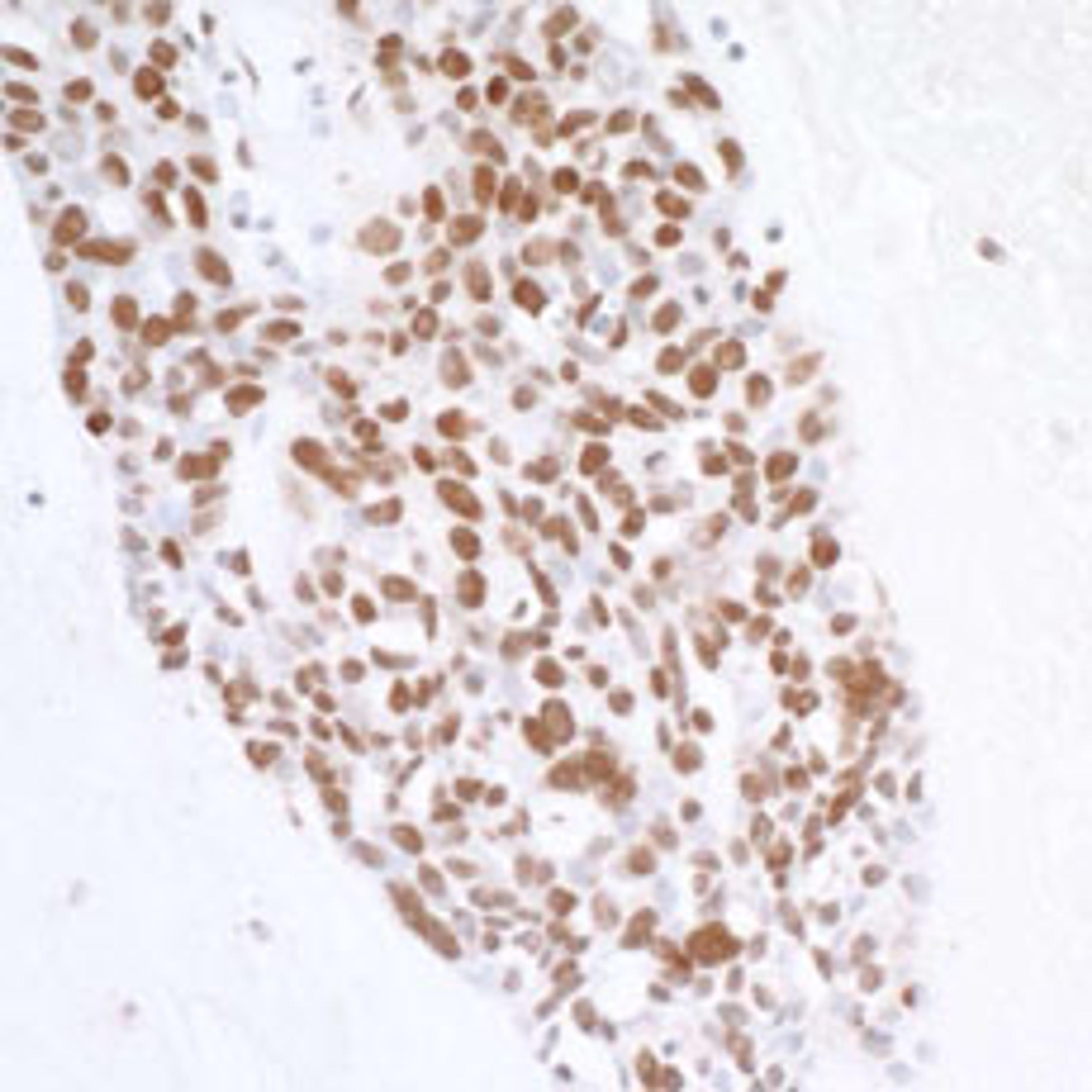 Detection of human H2AX by immunohistochemistry.