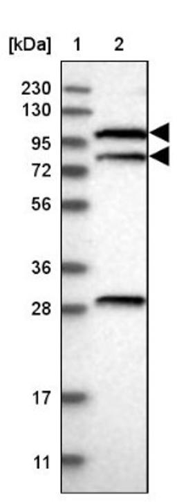 Western Blot: TRIM37 Antibody [NBP1-92529] - Lane 1: Marker [kDa] 230, 130, 95, 72, 56, 36, 28, 17, 11<br/>Lane 2: Human cell line RT-4