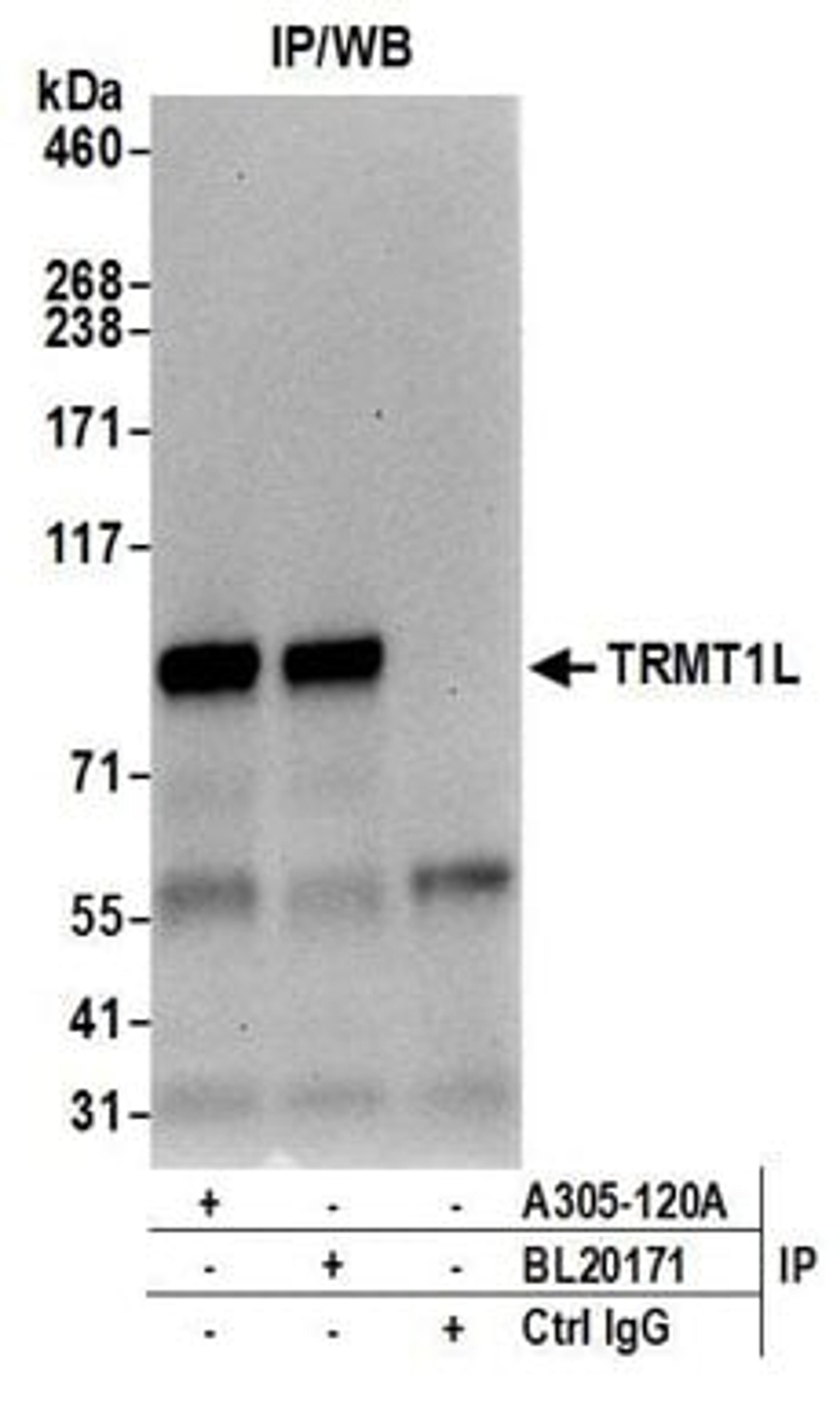 Detection of human TRMT1L by western blot of immunoprecipitates.