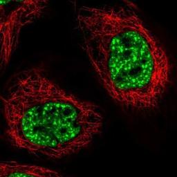 Immunocytochemistry/Immunofluorescence: FNBP3 Antibody [NBP1-87933] - Staining of human cell line A-431 shows positivity in nucleus but not nucleoli.