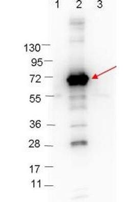 Western blot analysis of Molecular weight markers. and MBP-CRASP-1 fusion protein using CRASP-1 antibody