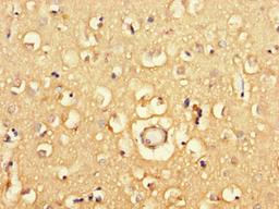 Immunohistochemistry of paraffin-embedded human brain tissue using CSB-PA883397LA01HU at dilution of 1:100