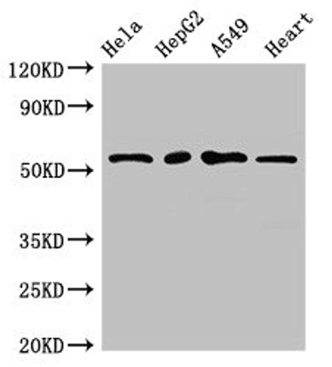 Western Blot. Positive WB detected in: Hela whole cell lysate, HepG2 whole cell lysate, A549 whole cell lysate, Mouse heart tissue. All lanes: MEF2D antibody at 2.7µg/ml. Secondary. Goat polyclonal to rabbit IgG at 1/50000 dilution. Predicted band size: 56, 57, 51, 50 kDa. Observed band size: 56 kDa