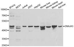 Western blot analysis of extracts of various cell lines using DNAJA3 antibody