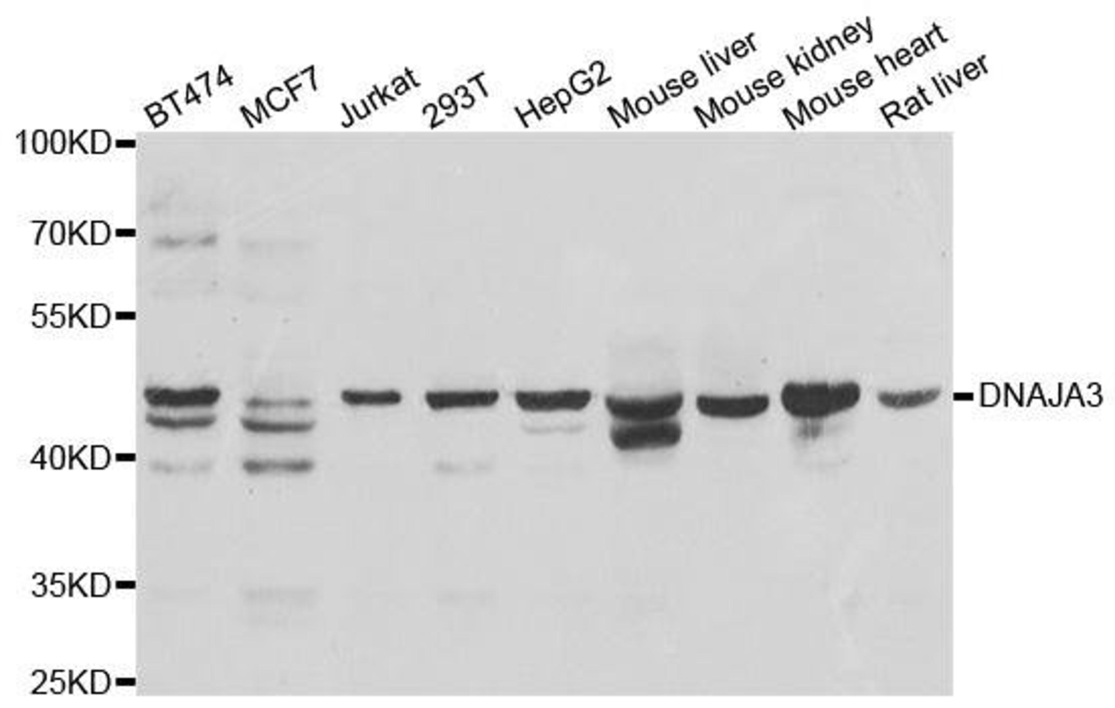 Western blot analysis of extracts of various cell lines using DNAJA3 antibody