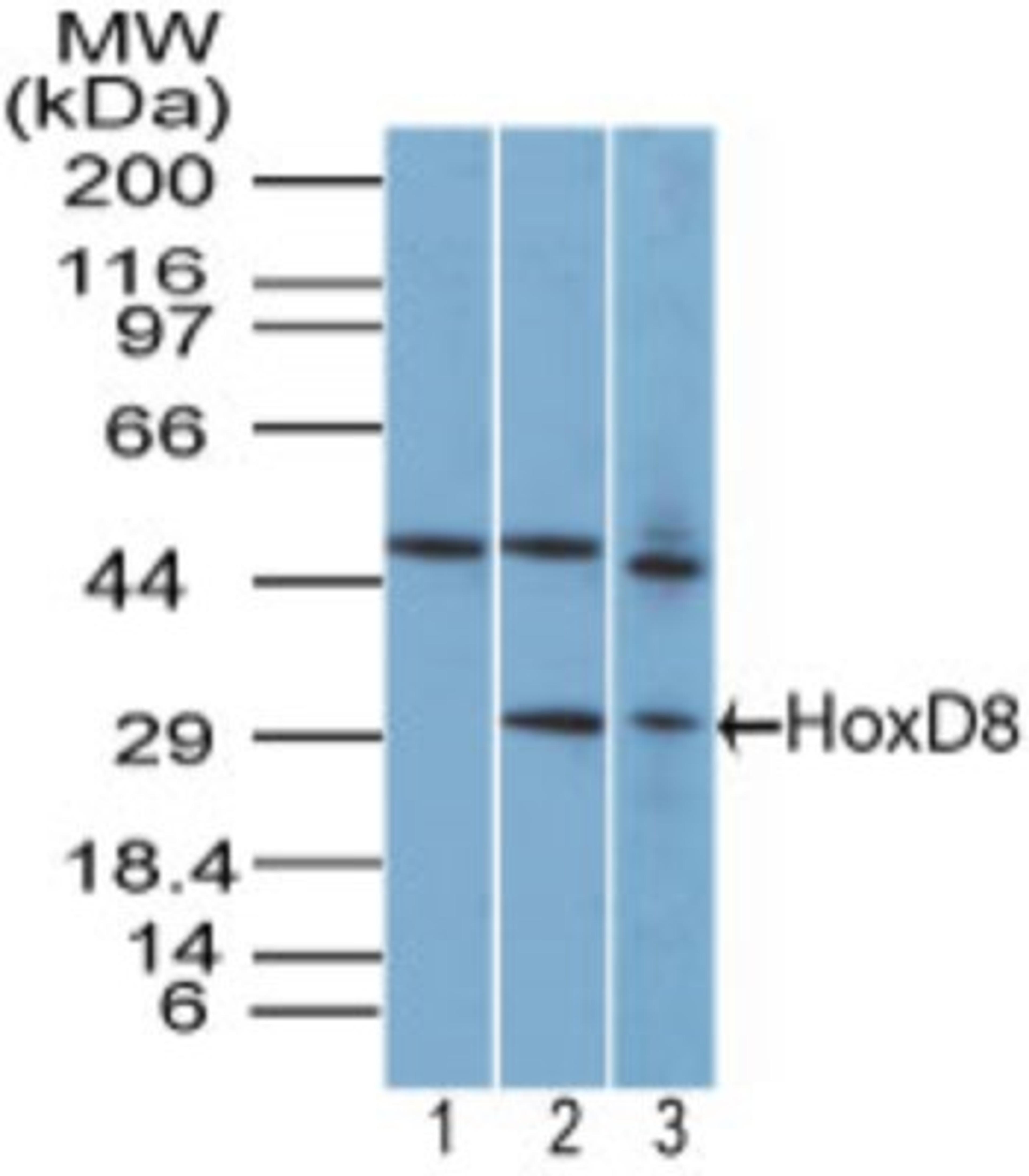 Western Blot: HOXD8 Antibody [NBP2-27108] - Analysis of HOXD8 in T98G cell lysate in the 1) pre-bleed at 1:5000 dilution 2) T98G cell lysate and 3) NIH 3T3 cell lysate using this antibody. Goat anti-rabbit Ig HRP secondary antibody and PicoTect ECL substrate solution were used for this test.