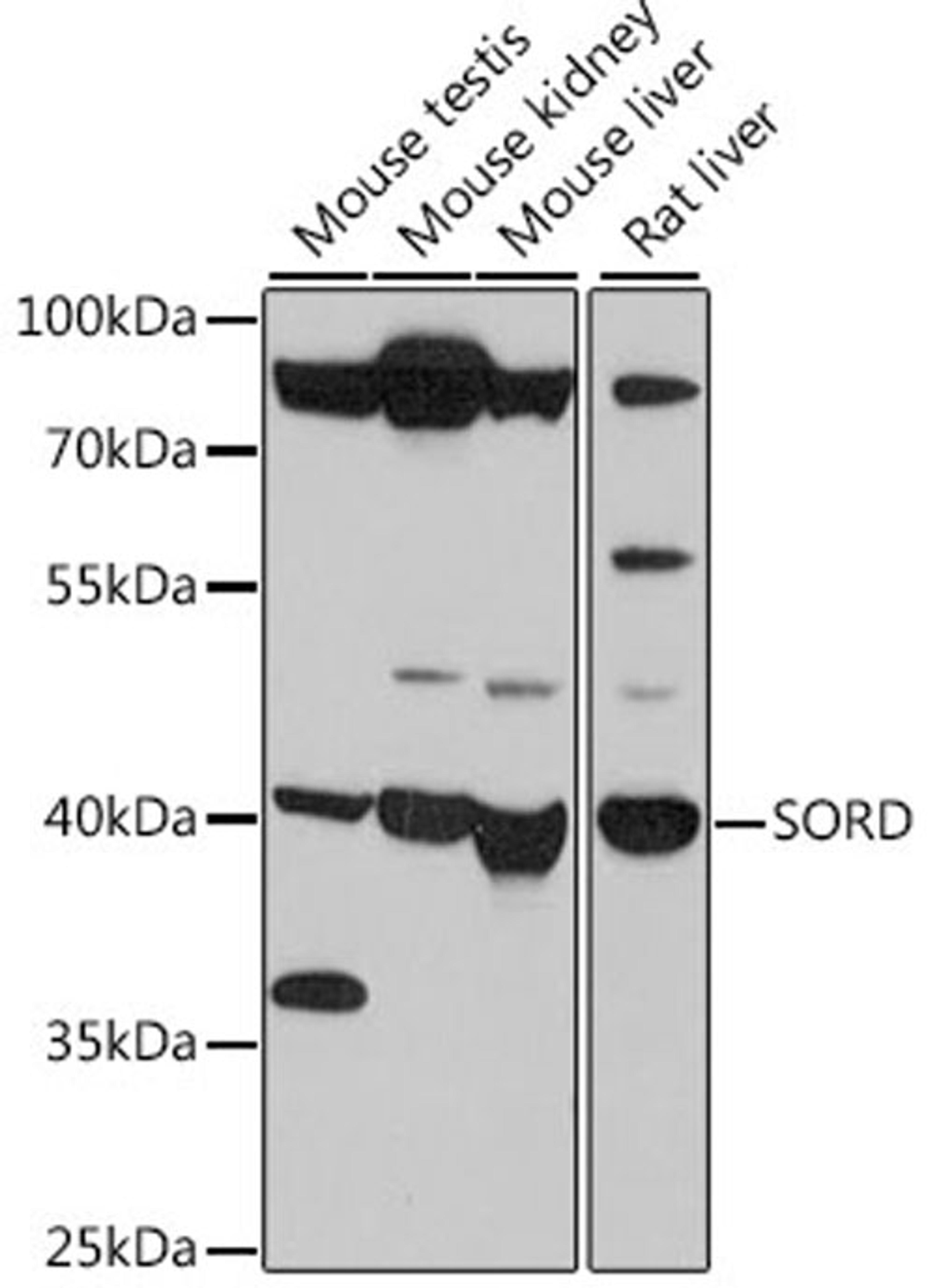 Western blot - SORD antibody (A15727)