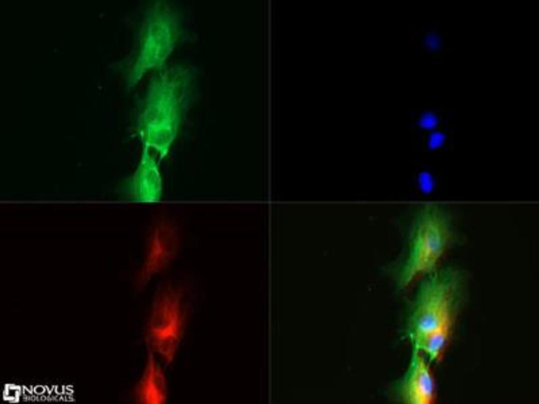 Immunocytochemistry/Immunofluorescence: SUCNR1/GPR91 Antibody [NBP1-00861] - GRP1 antibody (1:50) was tested in HUVEC cells with Dylight 488 (green). Nuclei and alpha-tubulin were counterstained with DAPI (blue) and Dylight 550 (red). Image objective 40x.