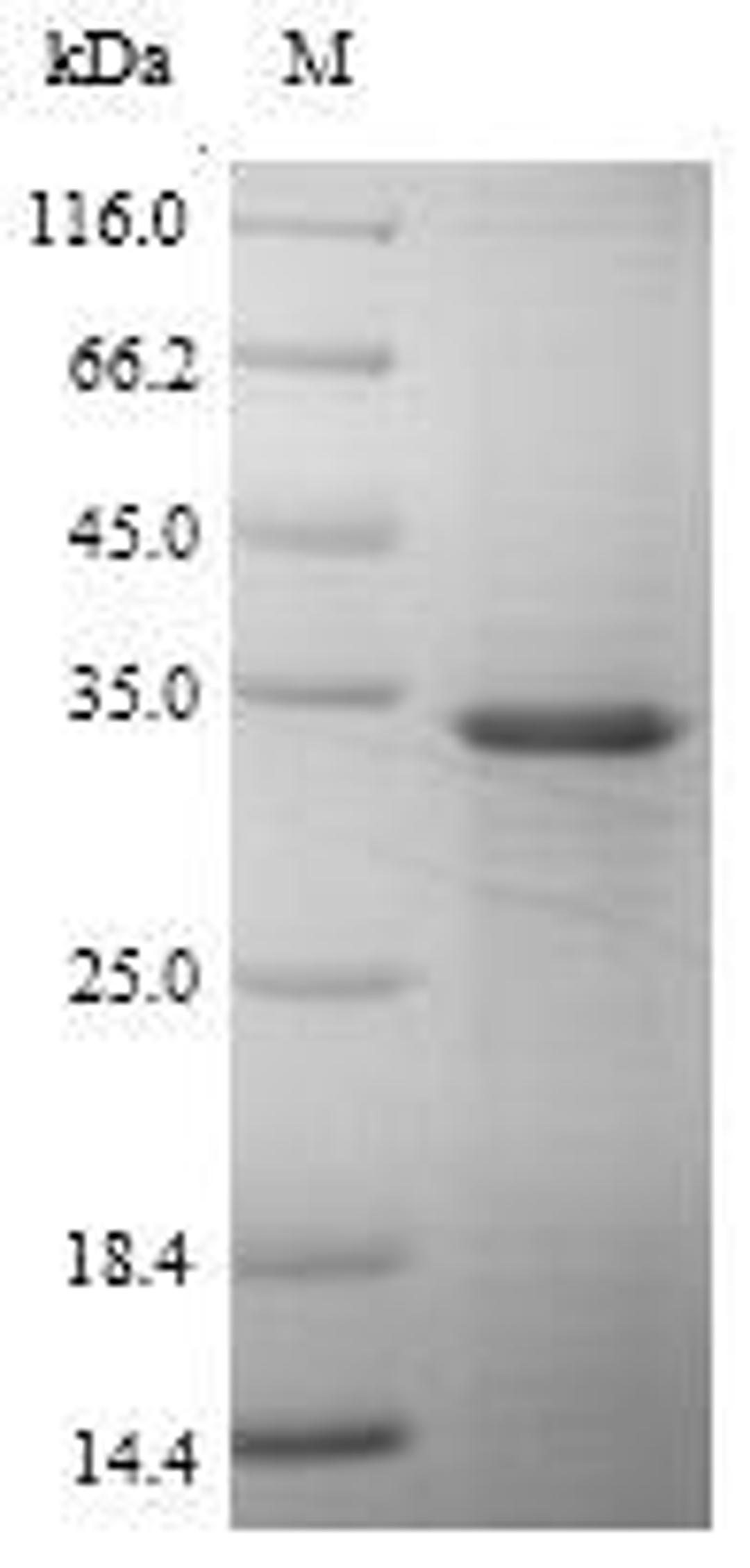 (Tris-Glycine gel) Discontinuous SDS-PAGE (reduced) with 5% enrichment gel and 15% separation gel.