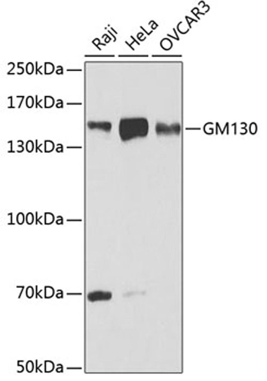 Western blot - GM130 antibody (A5344)