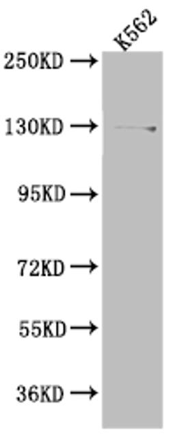 Western Blot. Positive WB detected in: K562 whole cell lysate. All lanes: HAUSP antibody at 1:1000. Secondary. Goat polyclonal to rabbit IgG at 1/50000 dilution. Predicted band size: 129, 127 kDa. Observed band size: 140 kDa.