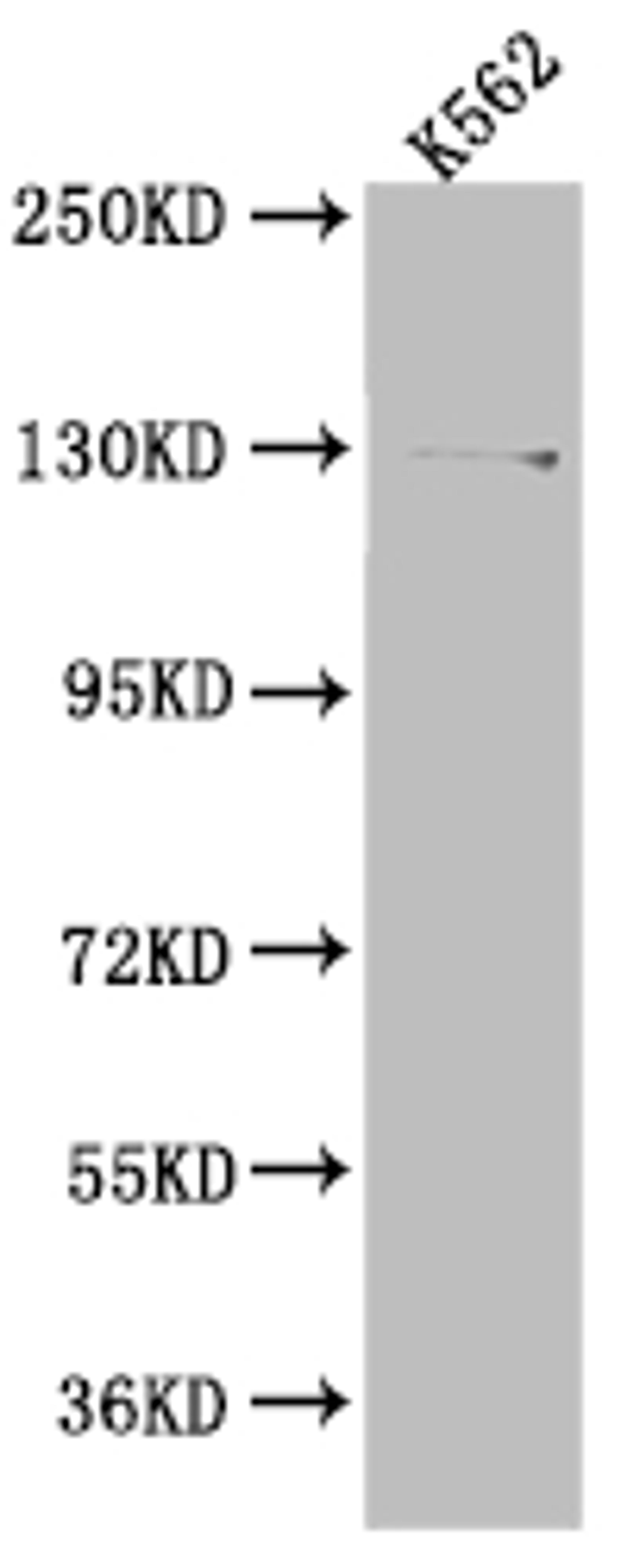 Western Blot. Positive WB detected in: K562 whole cell lysate. All lanes: HAUSP antibody at 1:1000. Secondary. Goat polyclonal to rabbit IgG at 1/50000 dilution. Predicted band size: 129, 127 kDa. Observed band size: 140 kDa.