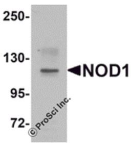 Western blot analysis of NOD1 in EL4 cell lysate with NOD1 antibody at 1 μg/mL.