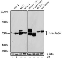 Western blot - Tissue Factor Rabbit mAb (A4395)