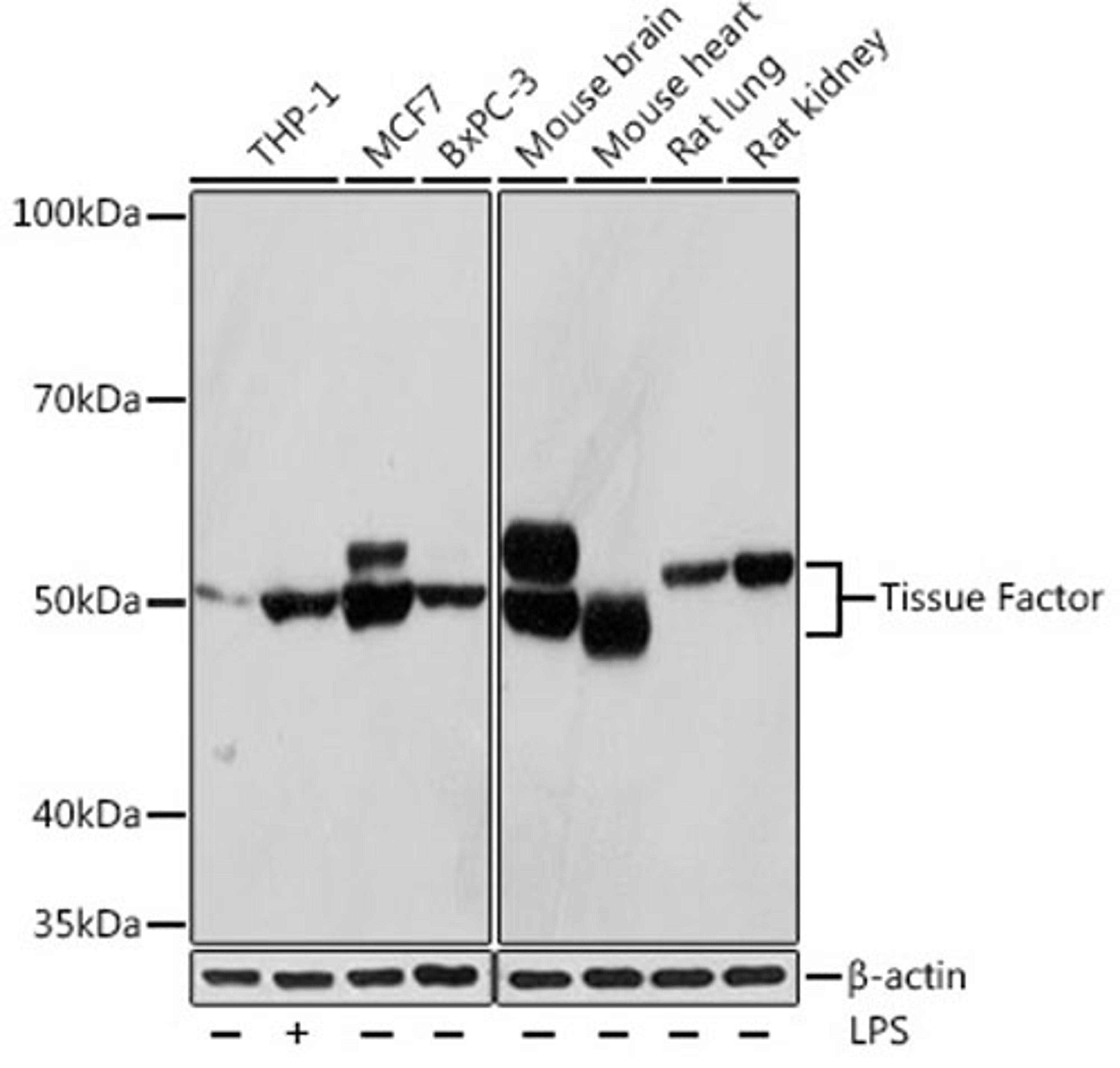 Western blot - Tissue Factor Rabbit mAb (A4395)