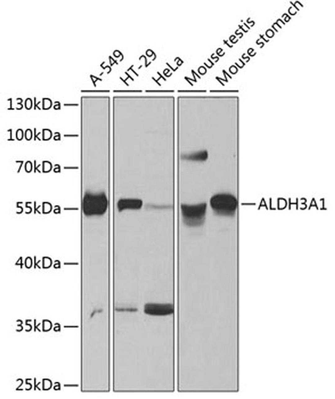 Western blot - ALDH3A1 antibody (A13275)