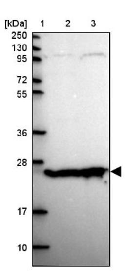 Western Blot: TPRG1 Antibody [NBP2-13471] - Lane 1: Marker [kDa] 250, 130, 95, 72, 55, 36, 28, 17, 10<br/>Lane 2: Human cell line RT-4<br/>Lane 3: Human cell line U-251MG sp