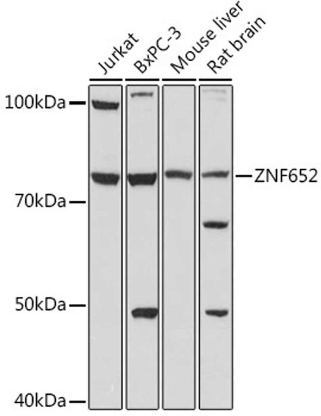 Western blot - ZNF652 antibody (A18657)