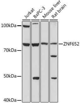 Western blot - ZNF652 antibody (A18657)